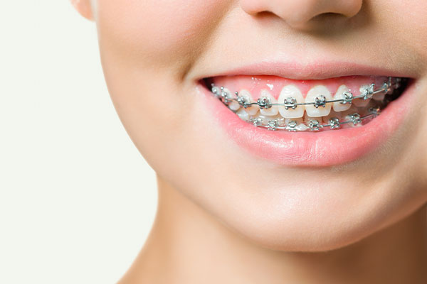Wellwood Family Dentistry | Root Canals, Implant Retained Dentures and Dental Cleanings