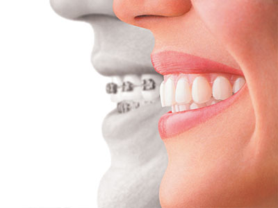Wellwood Family Dentistry | Pediatric Emergencies, Root Canals and In-Office Whitening