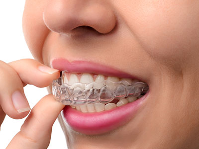 Wellwood Family Dentistry | Emergency Treatment, Dental Bridges and Extractions