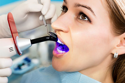 Wellwood Family Dentistry | Night Guards, Pediatric Emergencies and All-On-X