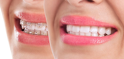 Wellwood Family Dentistry | Dental Cleanings, Preventative Program and Oral Exams