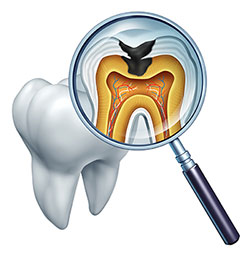 Wellwood Family Dentistry | Dental Fillings, Your Child s First Visit and Implant Retained Dentures