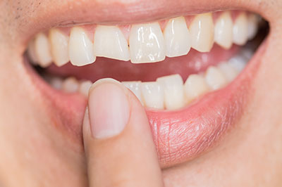 Wellwood Family Dentistry | Cosmetic Dentistry, Preventive Care and Dental Cleanings