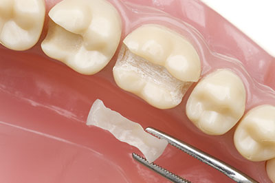 Wellwood Family Dentistry | Implant Retained Dentures, Pediatric Dentistry and Digital Impressions