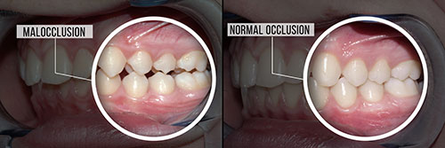 Wellwood Family Dentistry | Invisalign reg , Preventative Program and Dental Implants