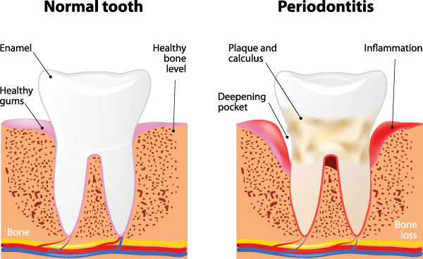 Wellwood Family Dentistry | TMD TMJ, Dental Lab and Preventative Program