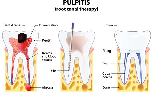 Wellwood Family Dentistry | Dental Lab, Dental Cleanings and Implant Retained Dentures
