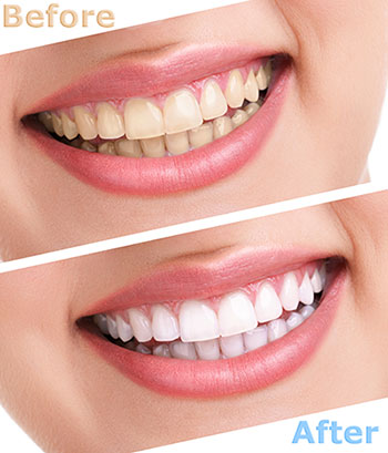 Wellwood Family Dentistry | Oral Exams, Extractions and Dental Implants
