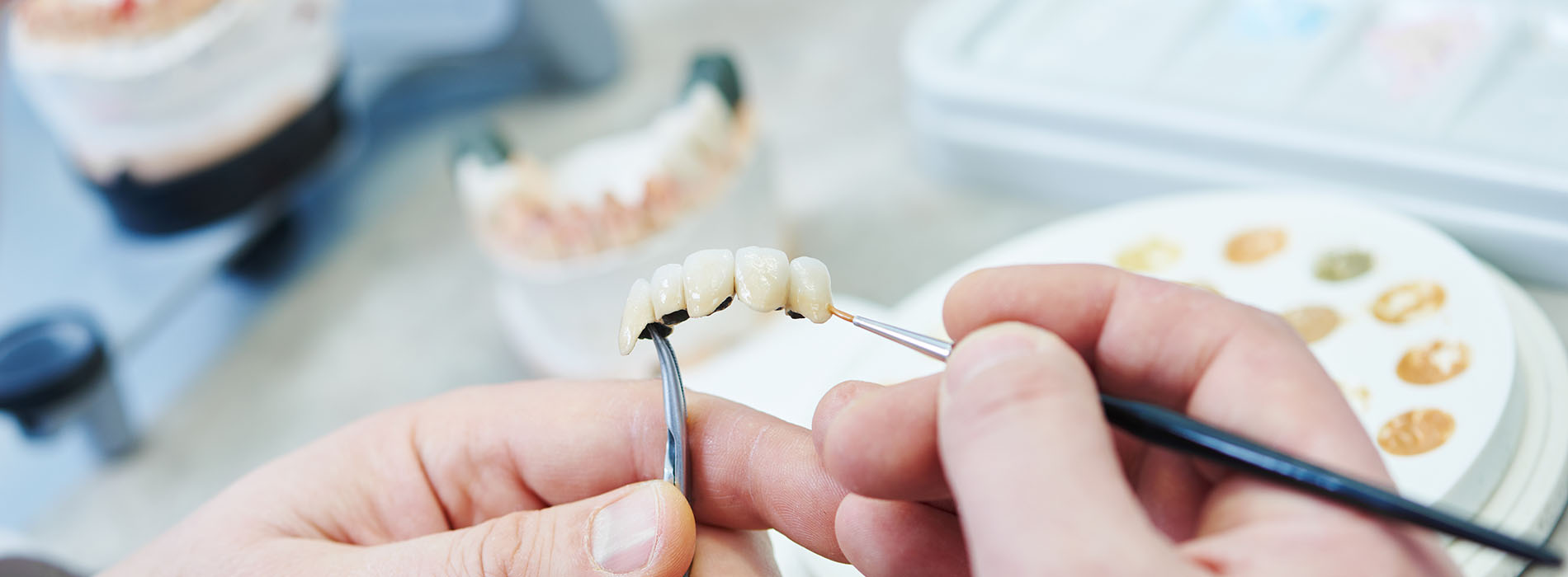 Wellwood Family Dentistry | Night Guards, Full Mouth Reconstruction and Pediatric Dentistry