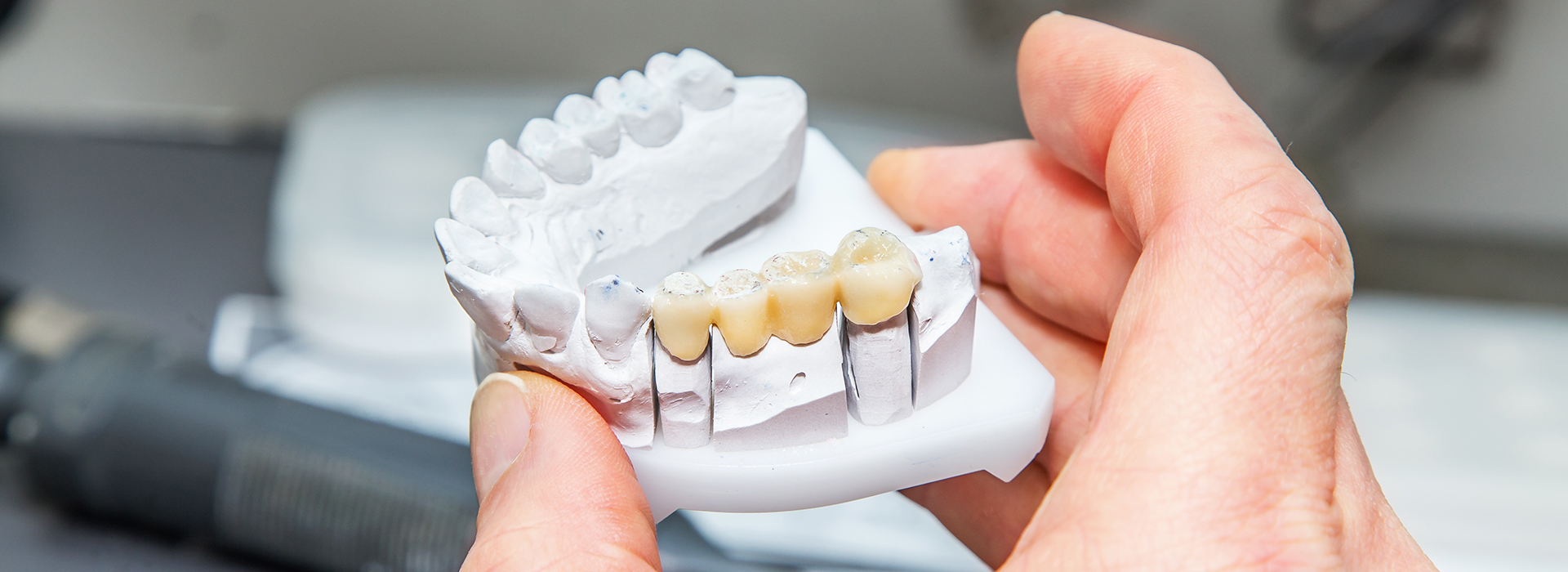 Wellwood Family Dentistry | Smile Assessment, Dental Lab and Extractions