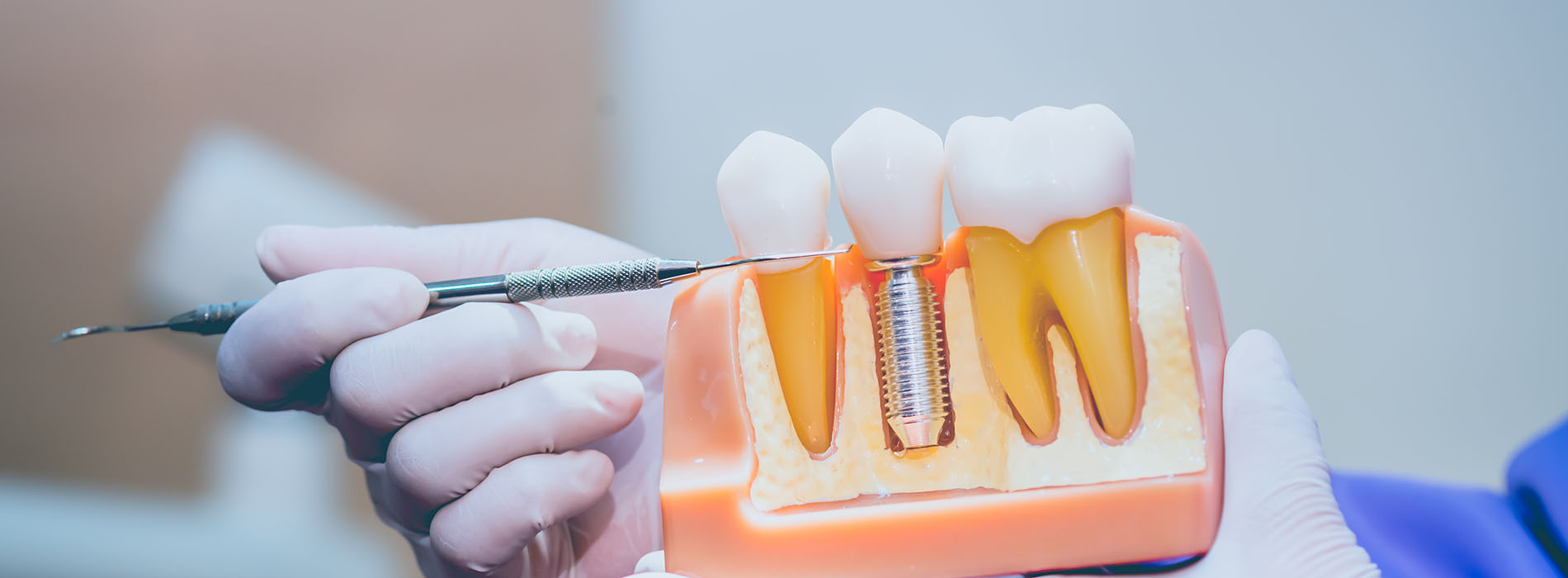 Wellwood Family Dentistry | Dental Lab, Root Canals and Veneers